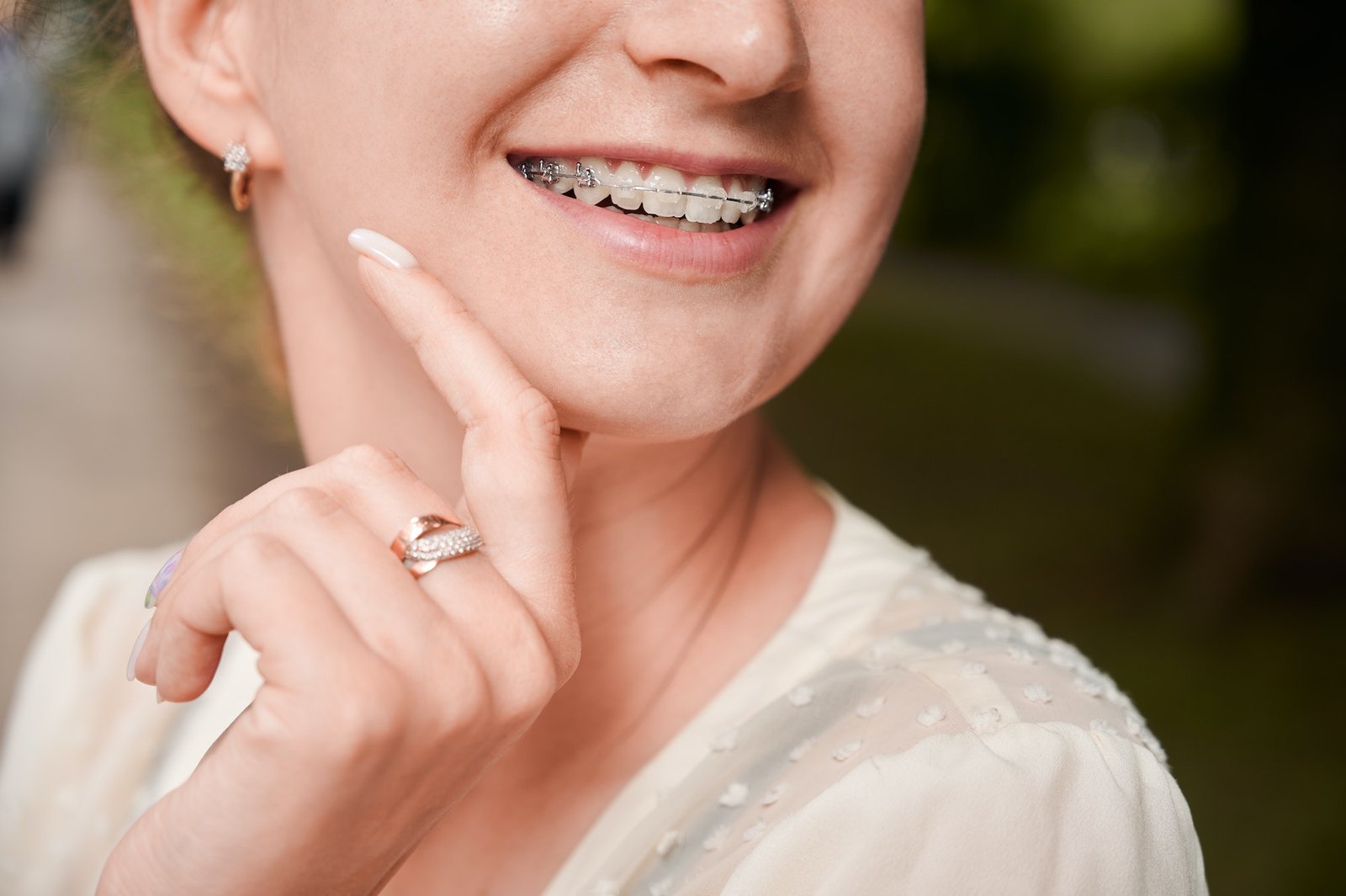 La complémentaire santé : un indispensable pour couvrir vos frais d’orthodontiste