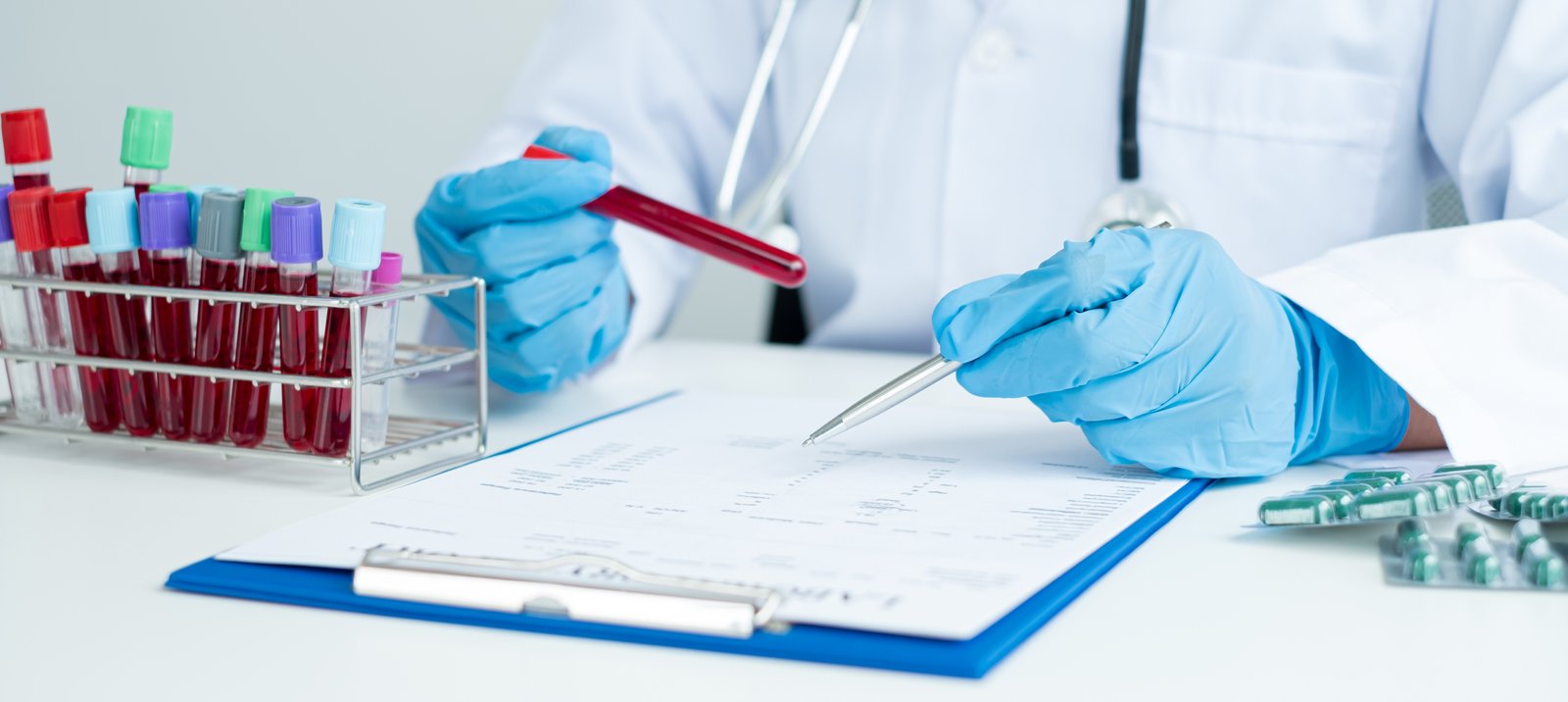 Professional doctors perform tests from samples of blood tests to diagnose virus infections analysis